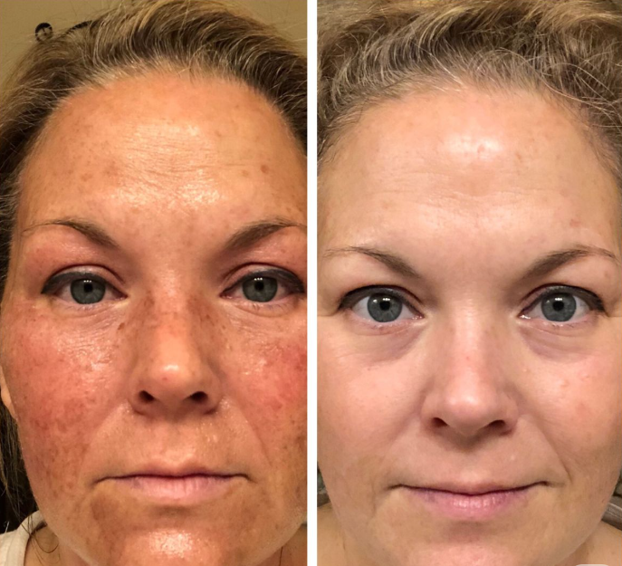 Lunava® Balsamo de Sebo de res