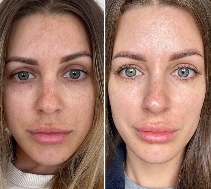 Lunava® Balsamo de Sebo de res