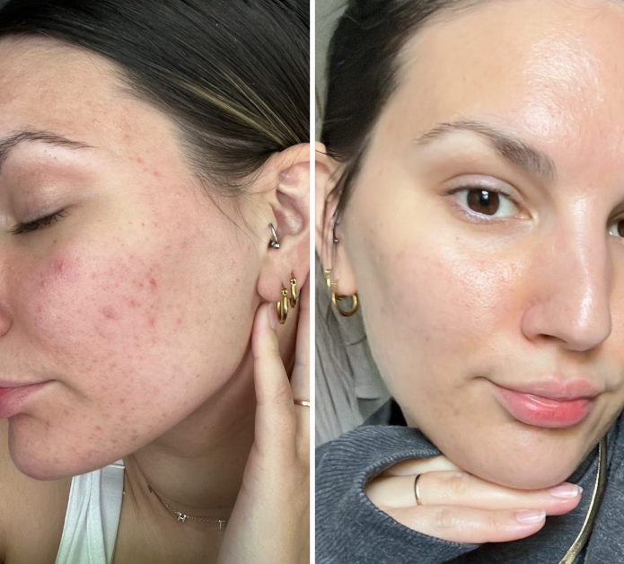 Lunava® Balsamo de Sebo de res